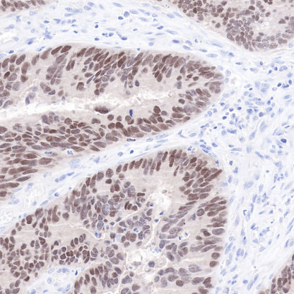 CDX2 Recombinant Rabbit mAb (SDT-134-76)