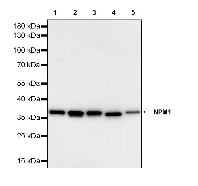 NPM1 Recombinant Rabbit mAb (S-4119-58)