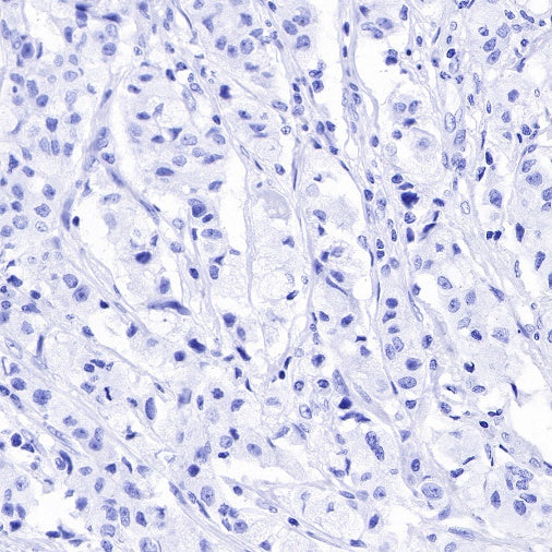 CA125 Recombinant Rabbit mAb (SDT-555-41)