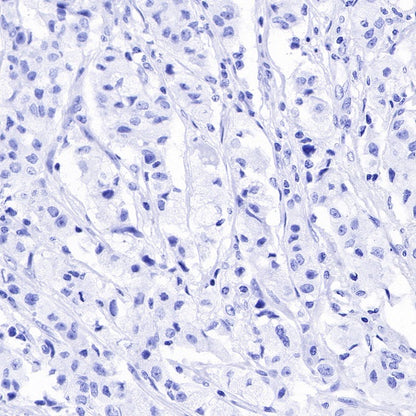 CA125 Recombinant Rabbit mAb (SDT-555-41)