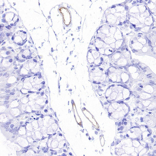 eNOS Recombinant Rabbit mAb (S-1885-94)