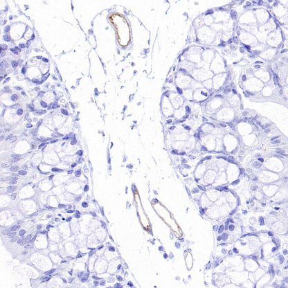 eNOS Recombinant Rabbit mAb (S-1885-94)