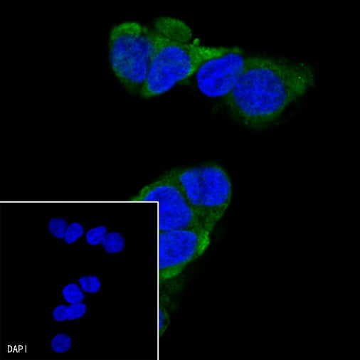 PEG10 Recombinant Rabbit mAb (SDT-442-60)