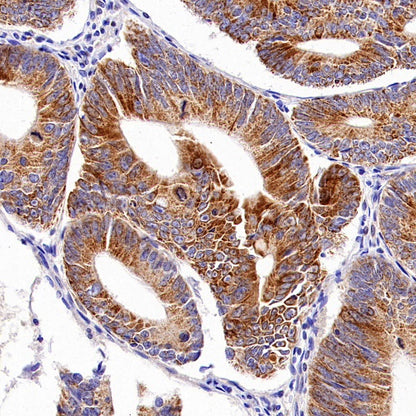 GLS1 Recombinant Rabbit mAb (S-2355-20)