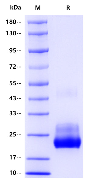 IL-6 His Tag Protein, Human