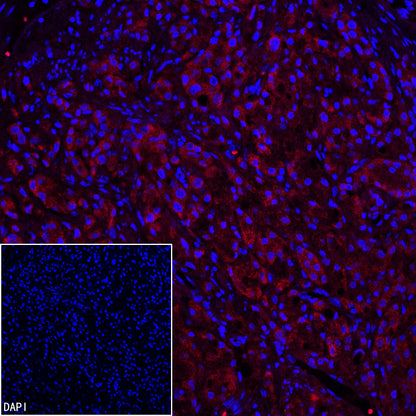 EpCAM Recombinant Rabbit mAb (PE Conjugate) (S-078-128)