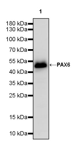 PAX6 Recombinant Rabbit mAb (SDT-1258-145)