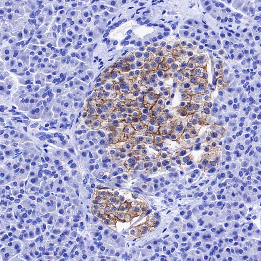 GPR75 Recombinant Rabbit mAb (S-5035)