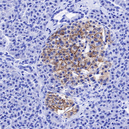 GPR75 Recombinant Rabbit mAb (S-5035)