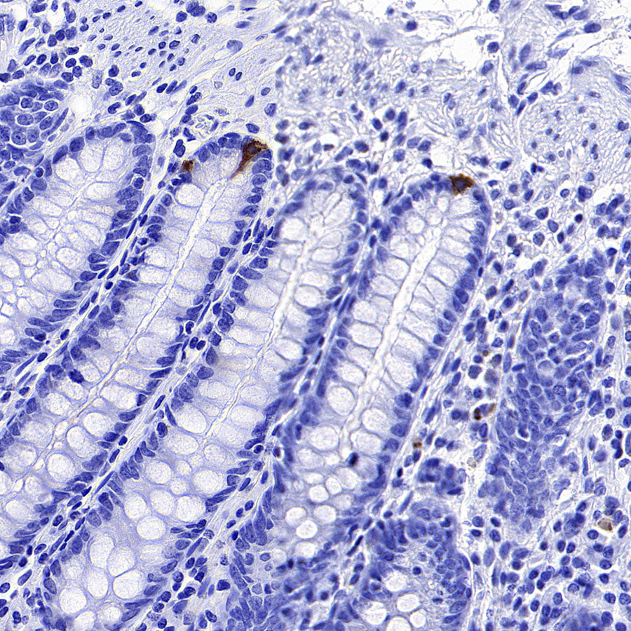 TIMP1 Recombinant Rabbit mAb (S-5147)