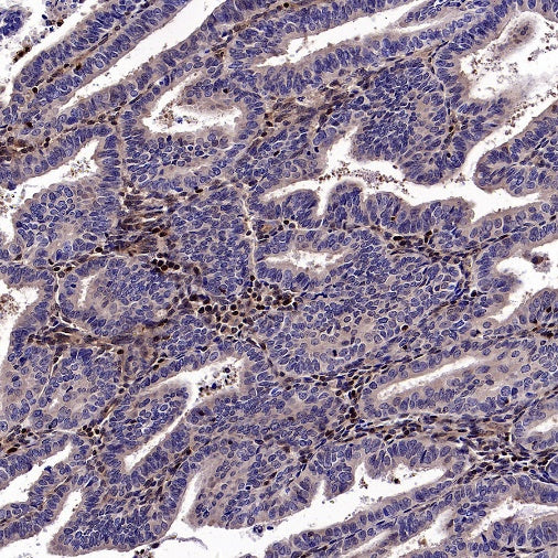 Stat5b Recombinant Rabbit mAb (S-2951-34)