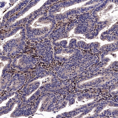 Stat5b Recombinant Rabbit mAb (S-2951-34)