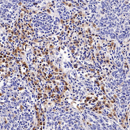 PLCγ2 Recombinant Rabbit mAb (S-2749-14)