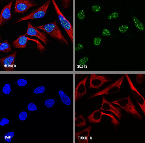 SUZ12 Recombinant Rabbit mAb (S-1689-3)