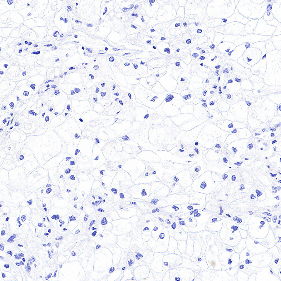 Cytokeratin 7 Recombinant Rabbit mAb (S-5954)
