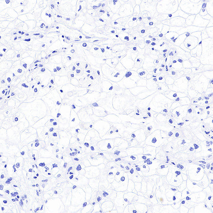 Cytokeratin 7 Recombinant Rabbit mAb (S-5954)