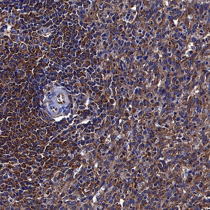 TRIM25 Recombinant Rabbit mAb (S-4069-59)