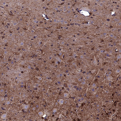 5HT1A Receptor Rabbit Polyclonal Antibody