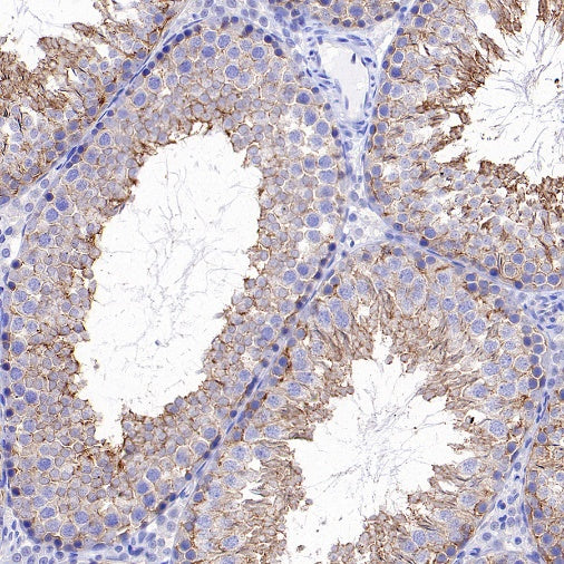 FYN Recombinant Rabbit mAb (S-2157-52)