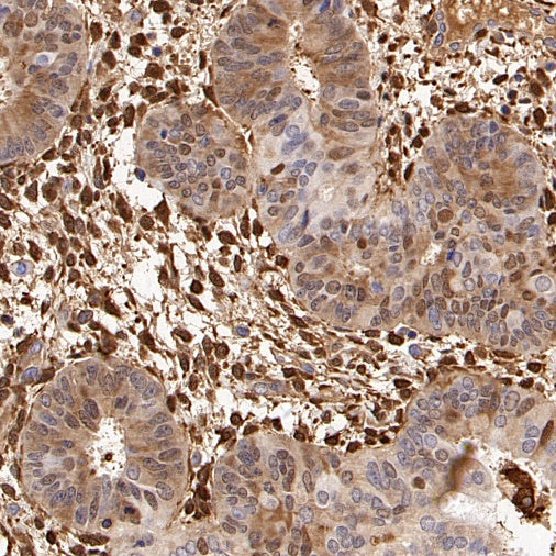 FTH1 Recombinant Rabbit mAb (S-1372-136)