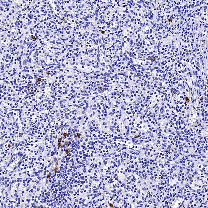 CLEC4C Recombinant Rabbit mAb (S-3825)