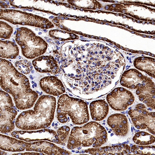 Fumarate hydratase Recombinant Rabbit mAb (SDT-2394-36)