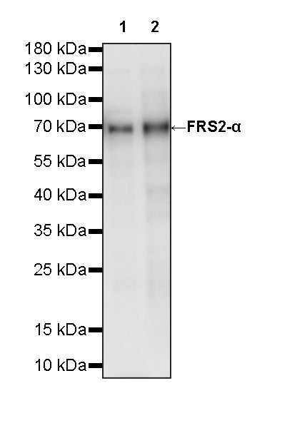 FRS2-α Recombinant Rabbit mAb (S-4065-59)