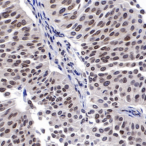 SUMO-1 Recombinant Rabbit mAb (S-625-111)