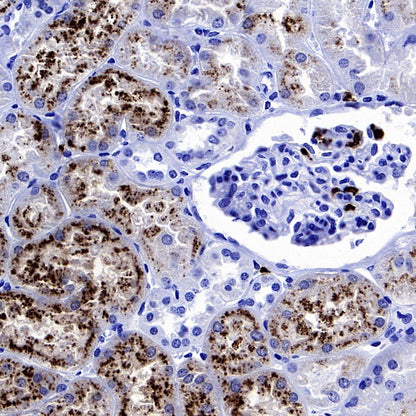 Lipocalin-2/NGAL Recombinant Rabbit mAb (S-2279-72)