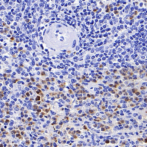 CHI3L1 Recombinant Rabbit mAb (S-324-38)