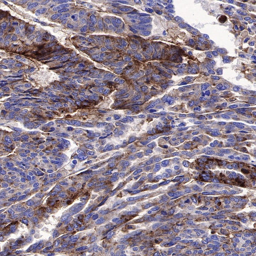 CD82 Recombinant Rabbit mAb (S-673-44)