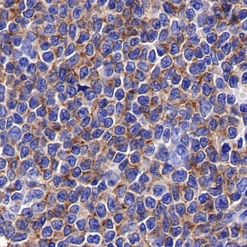 ROR1 Recombinant Rabbit mAb (SDT-R502-2)
