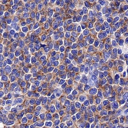 ROR1 Recombinant Rabbit mAb (SDT-R502-2)