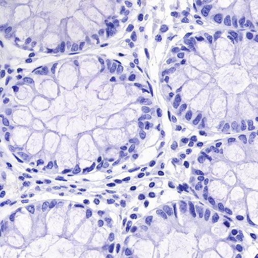 S-RMab® SOX10 Recombinant Rabbit mAb (SDT-R233)