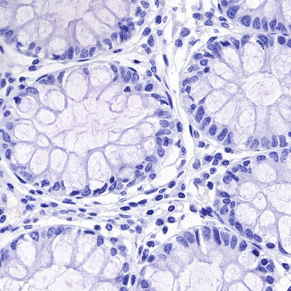 S-RMab® SOX10 Recombinant Rabbit mAb (SDT-R233)