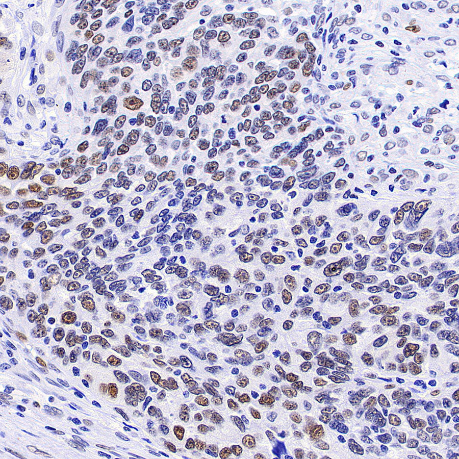 PAPSS1 Recombinant Rabbit mAb (S-3516-23)