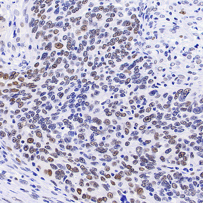 PAPSS1 Recombinant Rabbit mAb (S-3516-23)