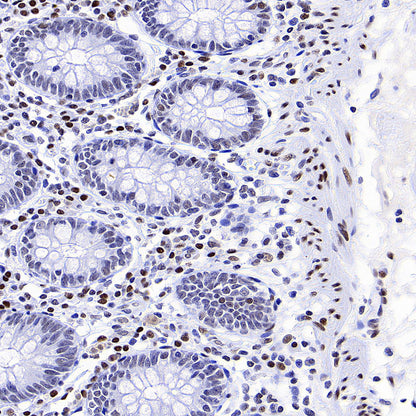 Bmi1 Recombinant Rabbit mAb (S-5143)