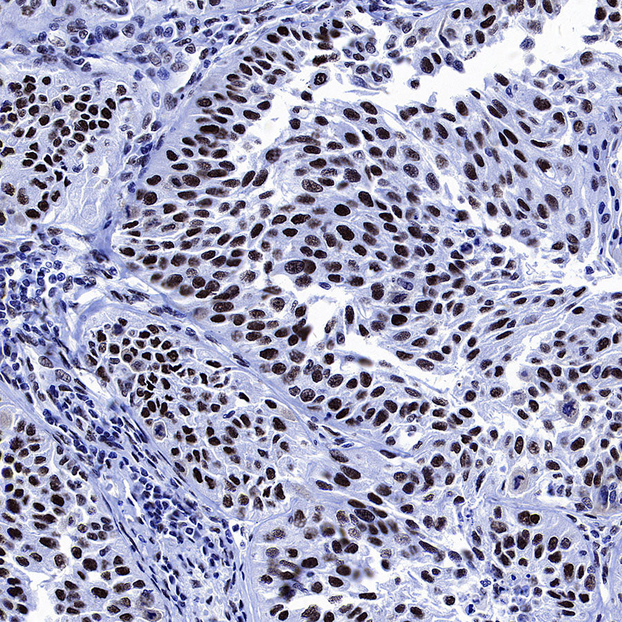 p300 Recombinant Rabbit mAb (S-2612-122)