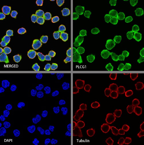 PLCG1 Recombinant Rabbit mAb (S-978-37)