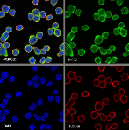PLCG1 Recombinant Rabbit mAb (S-978-37)