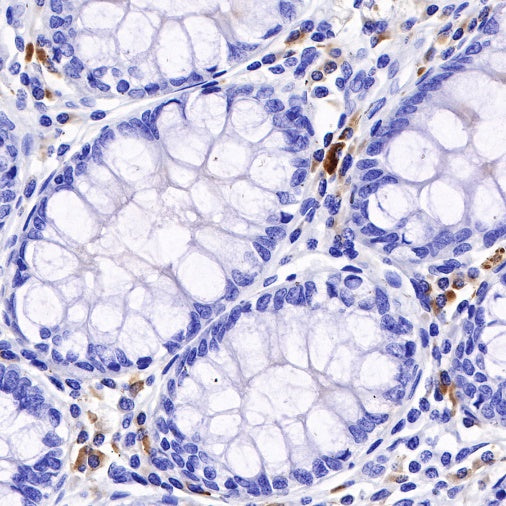 Kappa light chain Recombinant Rabbit mAb (S-385-23)