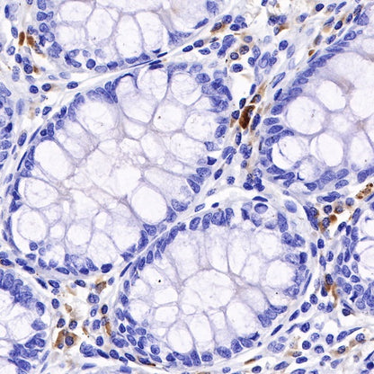 Kappa light chain Recombinant Rabbit mAb (S-385-23)
