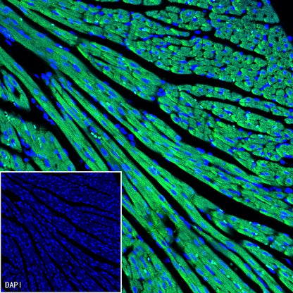 Sarcomeric Alpha Actinin Recombinant Rabbit mAb (S-1652-40)