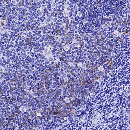 IGF2BP1 Recombinant Rabbit mAb (S-2947-19)