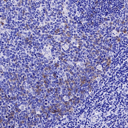 IGF2BP1 Recombinant Rabbit mAb (S-2947-19)