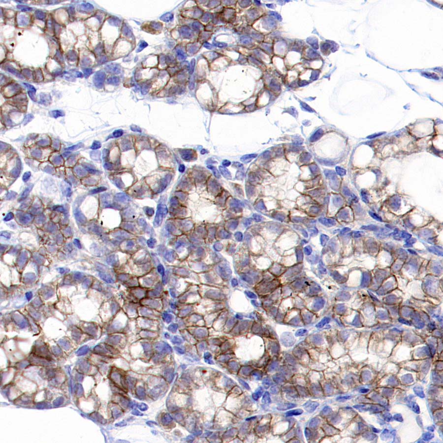 HER2/ErbB2 Recombinant Rabbit mAb (S-3935-58)