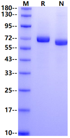 EphA6 His Tag Protein, Human