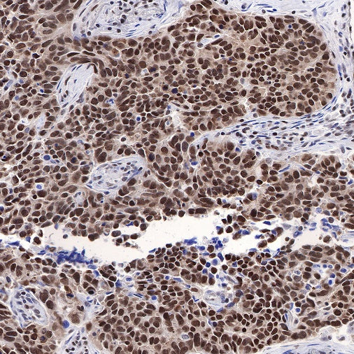FUBP1 Recombinant Rabbit mAb (S-739-21)
