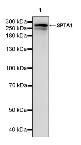 SPTA1 Recombinant Rabbit mAb (S-677-345)